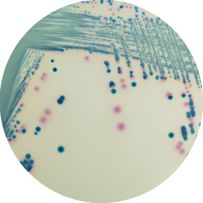 CHROMagar™ mSuperCARBA™ - 25 L